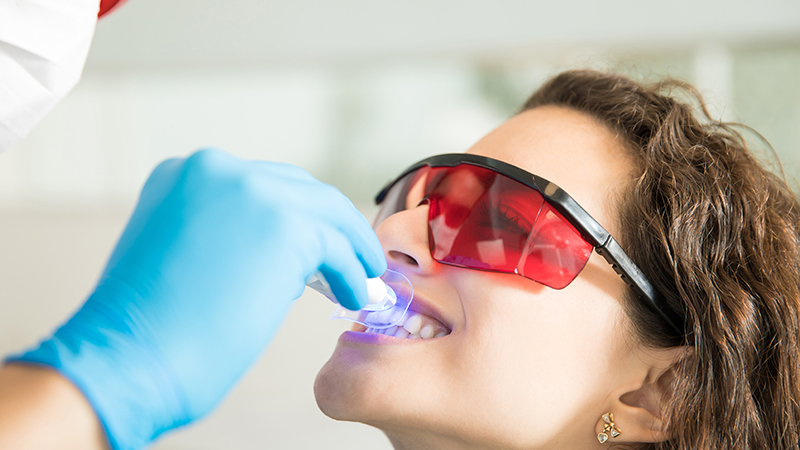 Teeth Whitening
